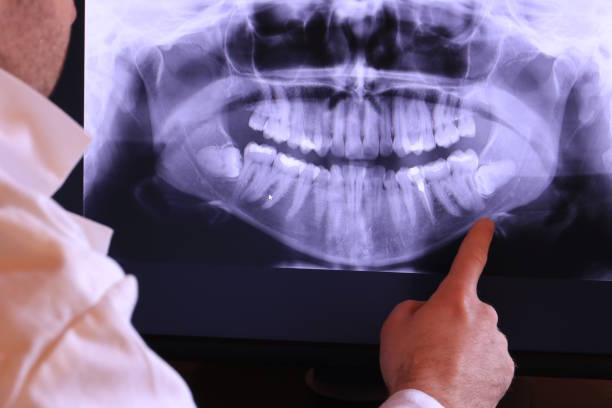 Best Dentist for Tooth Abscess  in Southport, NC