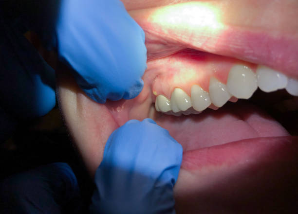 Best Root Canal Emergency Dentist  in Southport, NC